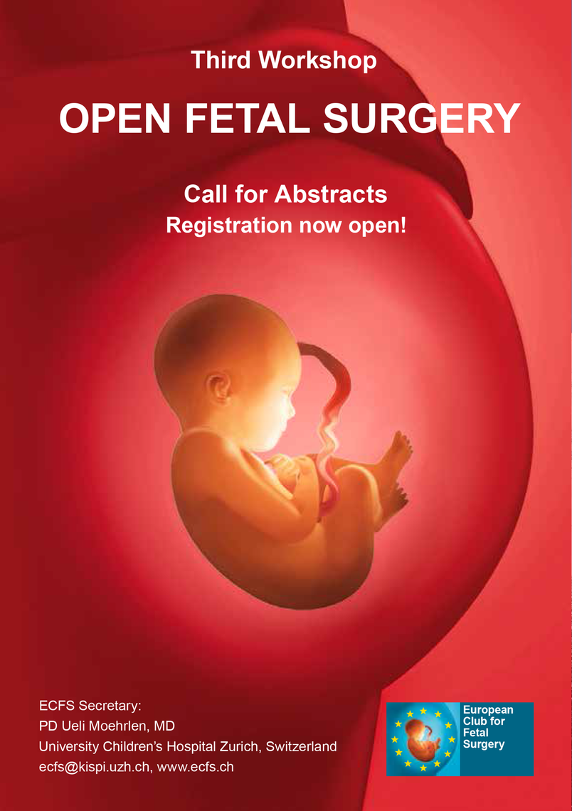 Third Workshop of the European Club for Fetal Surgery (ECFS)